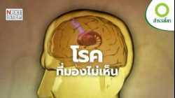 จากร่างกายที่พังทลาย สู่ความหวังด้วยเทคโนโลยี | สารคดี สำรวจโลก สงครามในร่างกาย