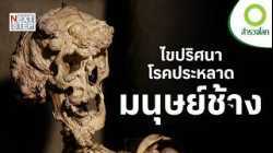 ไขปริศนาโรคประหลาดที่โลกยังหาคำตอบไม่ได้ | สารคดี สำรวจโลก ตอน เบื้องหลังมนุษย์ช้าง