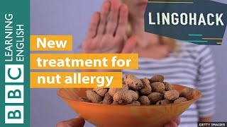 New treatment for nut allergy - Lingohack