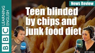 Teenager blinded by chips and junk food diet - News Review